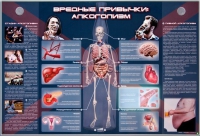 Электрифицированный стенд "Вредные привычки: алкоголизм" - «globural.ru» - Великие Луки