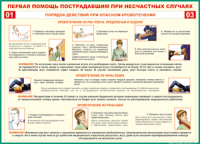 Таблица Порядок действий при опасном кровотечении 1000*1400 винил - «globural.ru» - Великие Луки