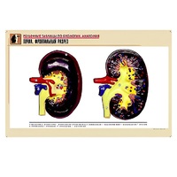 Рельефная таблица "Почка. Фронтальный разрез" (формат А1, матовое ламинир.) - «globural.ru» - Великие Луки